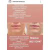 Микродермабразия механический пилинг -решение многих проблем с кожей